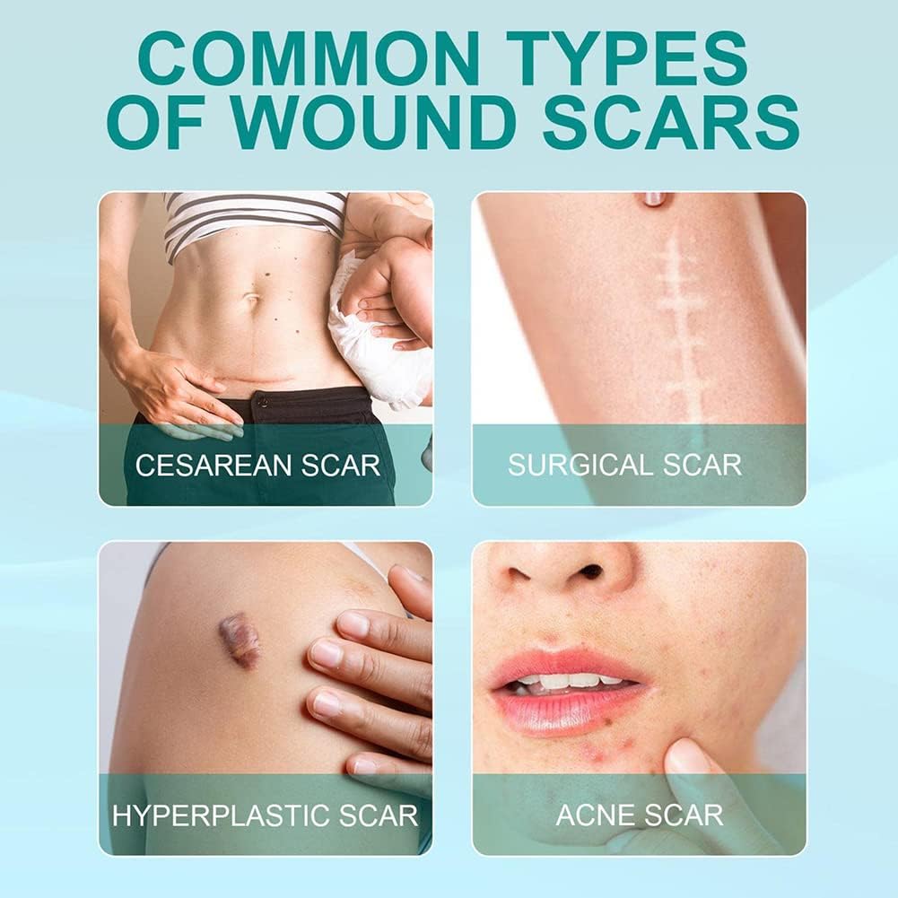 Scar Remove Spray : Dites Adieu aux Cicatrices naturellement